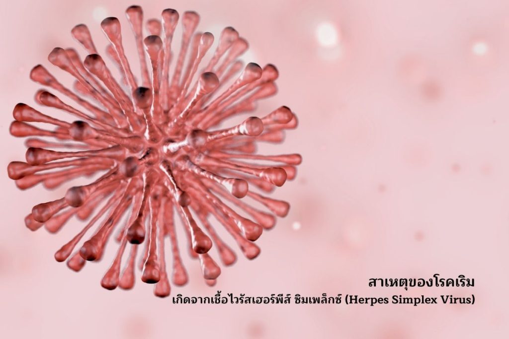 Herpes Simplex Virus
