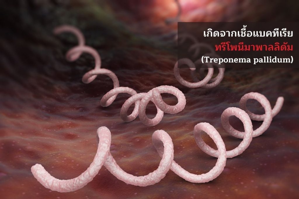 Treponema pallidum