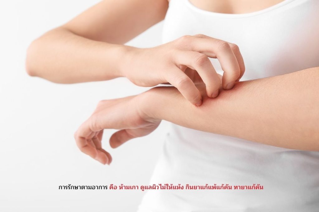 รักษาตามอาการ