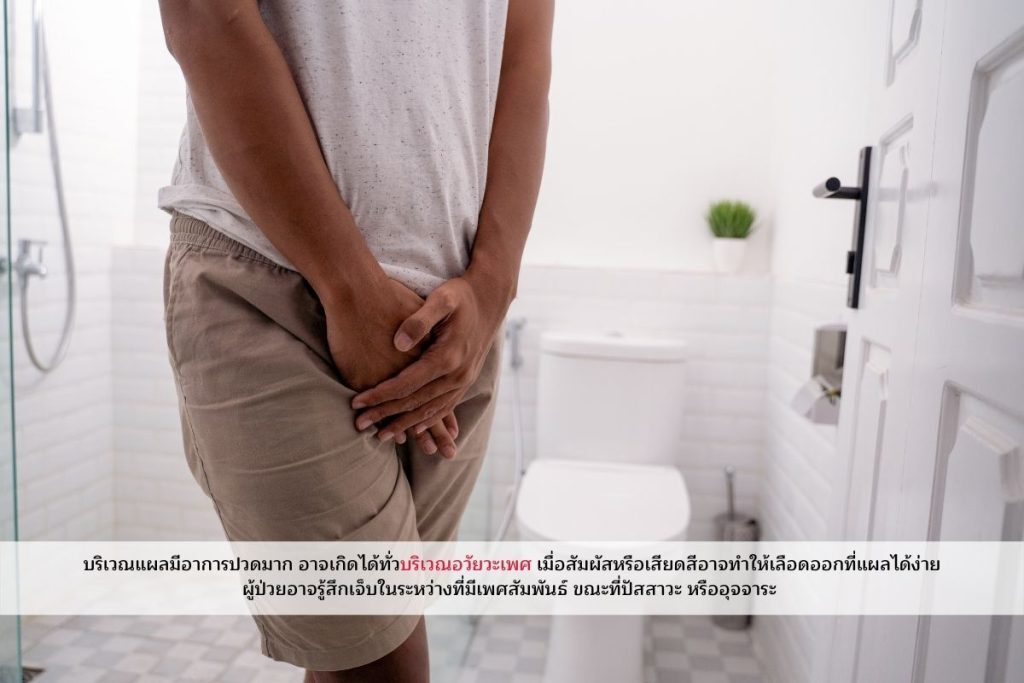 อาการแผลริมอ่อน