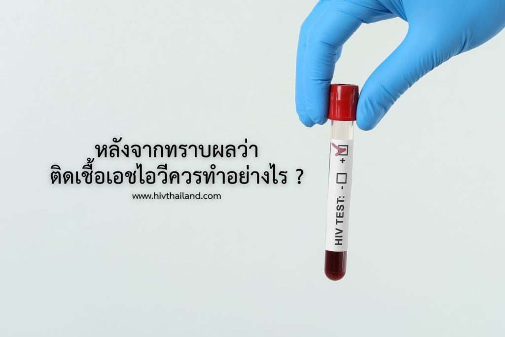 หลังจากทราบผลว่า ติดเชื้อเอชไอวีควรทำอย่างไร