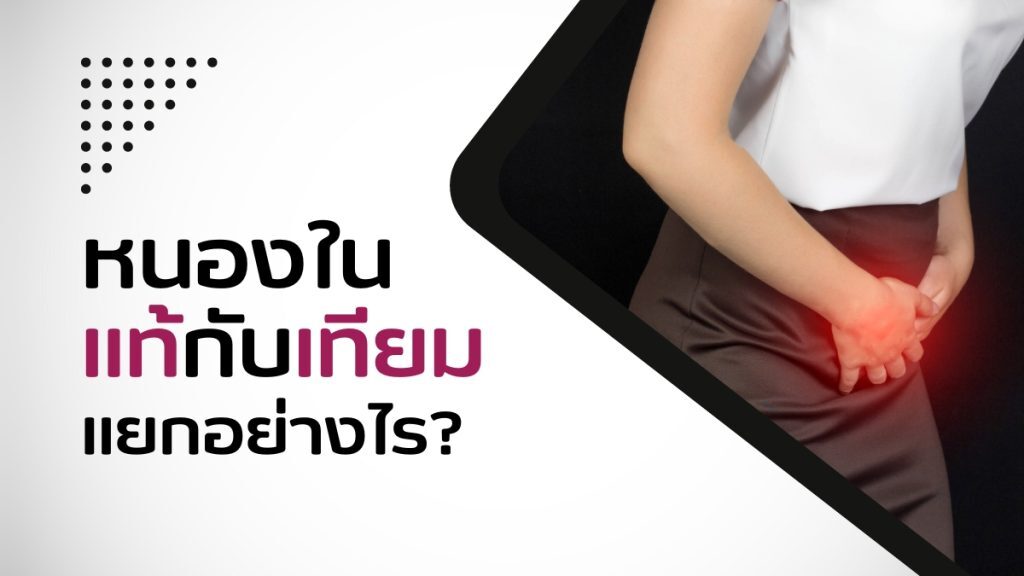 หนองใน แท้กับเทียม แยกอย่างไร