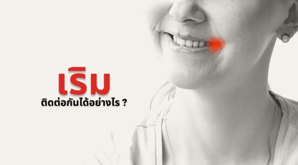 เริม ติดต่อกันได้อย่างไร