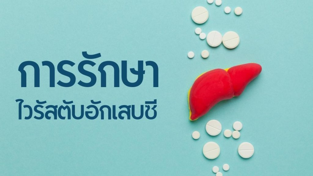 การรักษา ไวรัสตับอักเสบซี