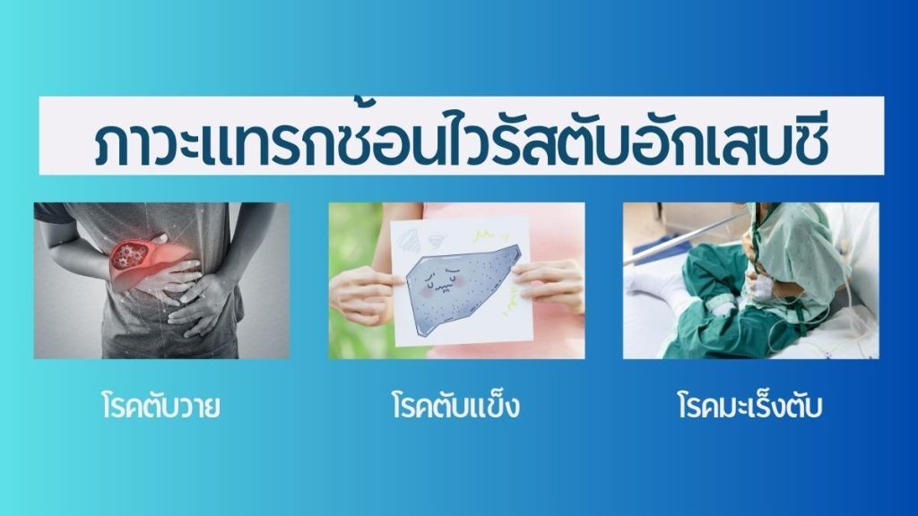ภาวะแทรกซ้อน ไวรัสตับอักเสบซี