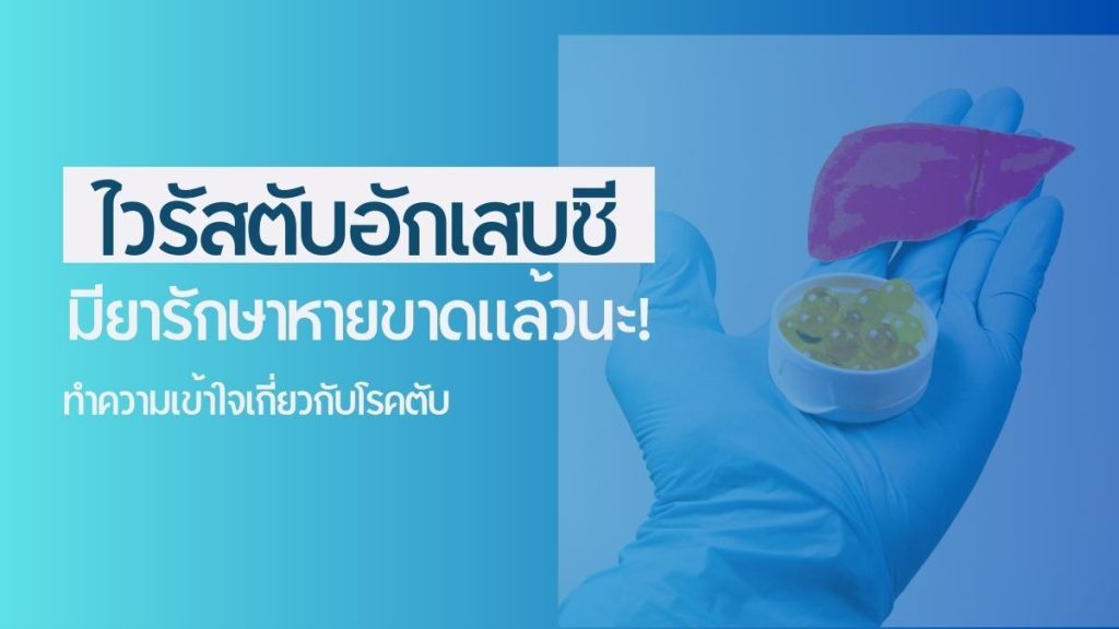 ไวรัสตับอักเสบซี มียารักษาหายขาดแล้วนะ