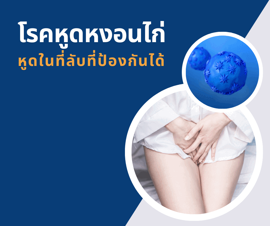 โรคหูดหงอนไก่ หูดในที่ลับที่ป้องกันได้