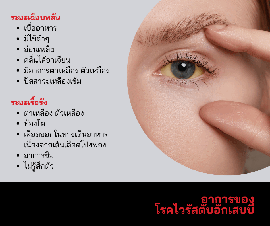 อาการของโรคไวรัสตับอักเสบบี