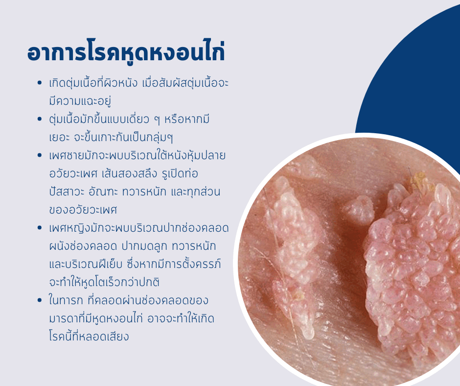 อาการโรคหูดหงอนไก่