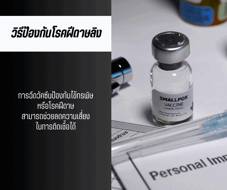 วิธีป้องกันโรคฝีดาษลิง