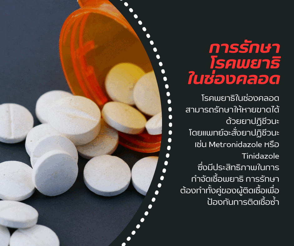 การรักษาโรคพยาธิในช่องคลอด