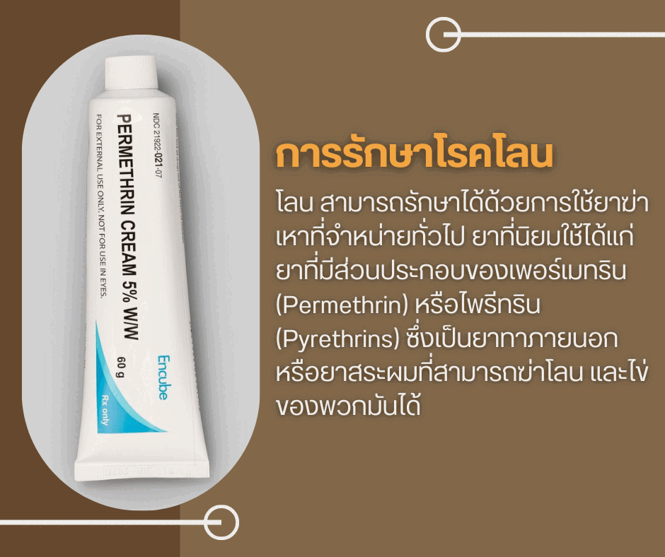 การรักษาโรคโลน