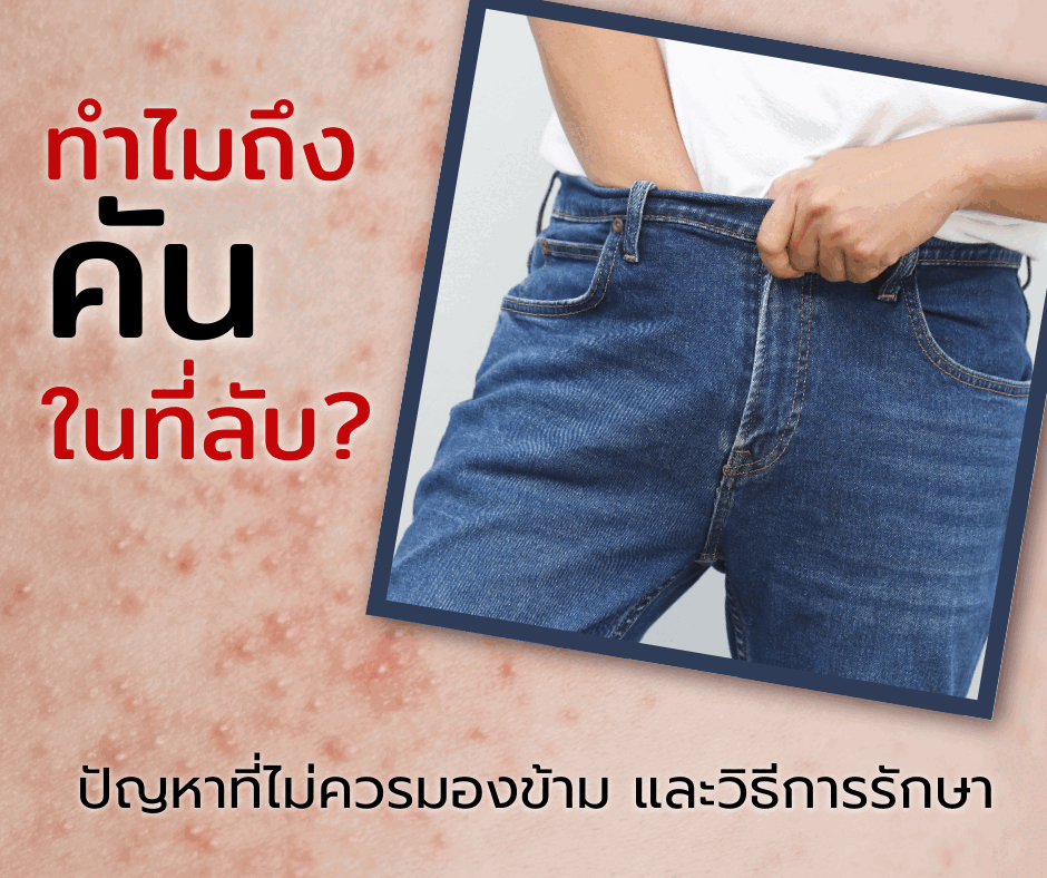 ทำไมถึงคันในที่ลับ? ปัญหาที่ไม่ควรมองข้าม และวิธีการรักษา