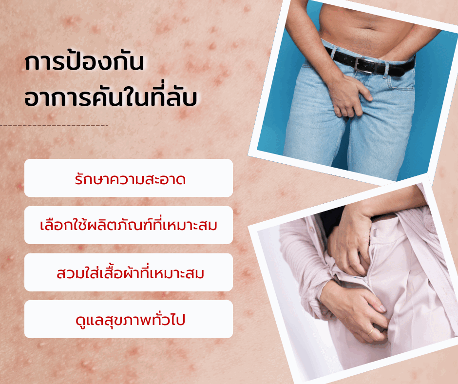 การป้องกันอาการคันในที่ลับ