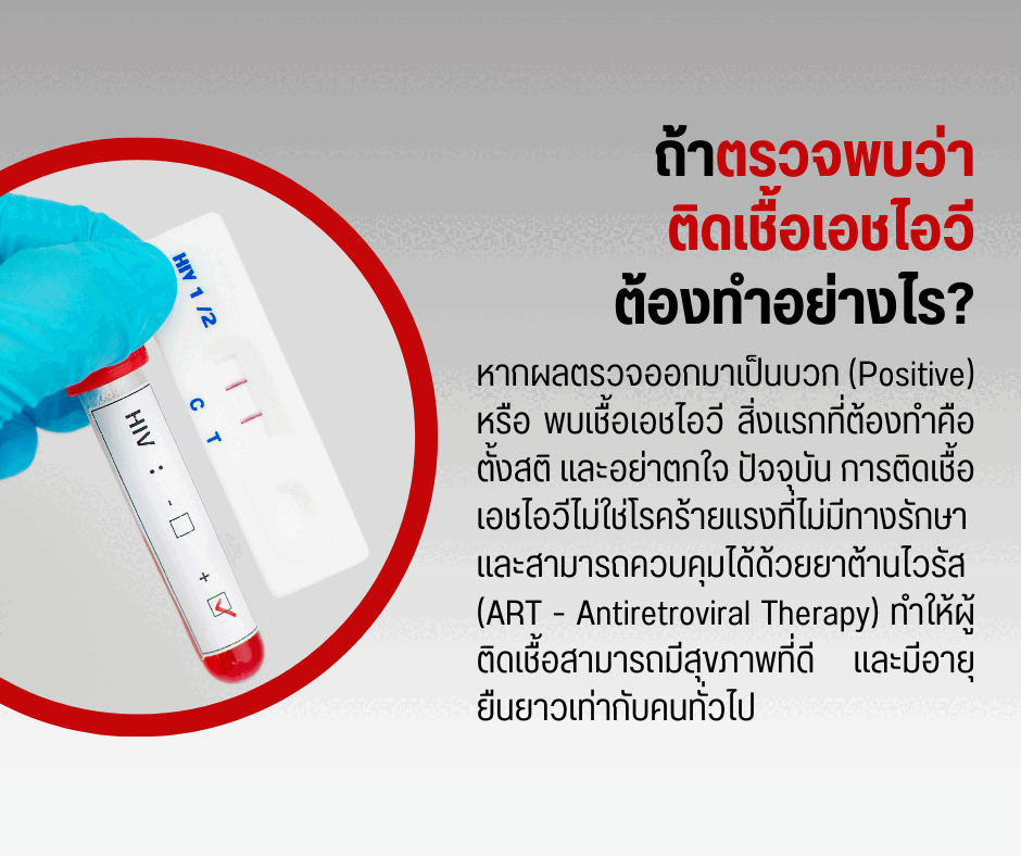 ถ้าตรวจพบว่าติดเชื้อเอชไอวีต้องทำอย่างไร?