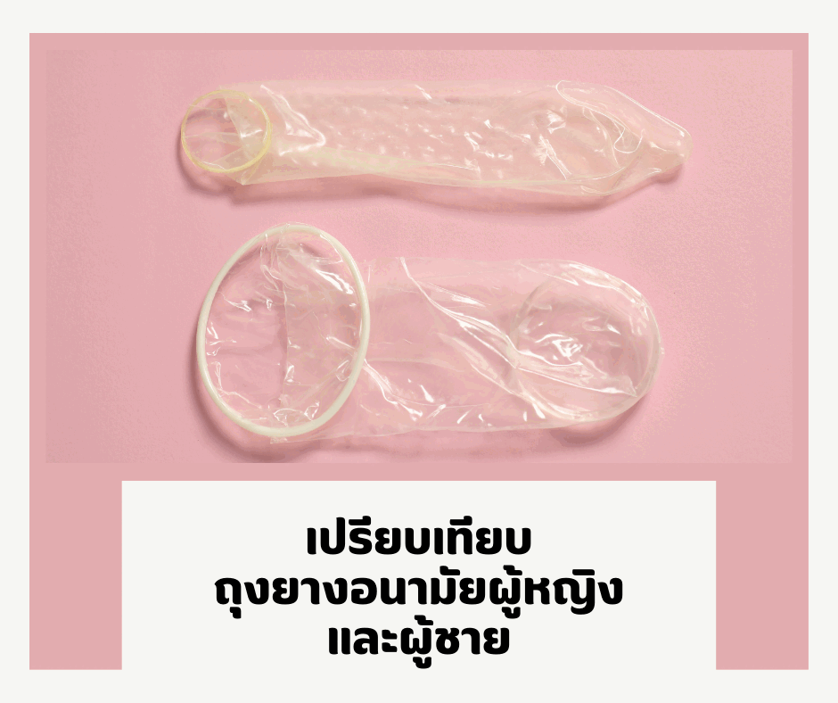 เปรียบเทียบถุงยางอนามัยผู้หญิง และผู้ชาย
