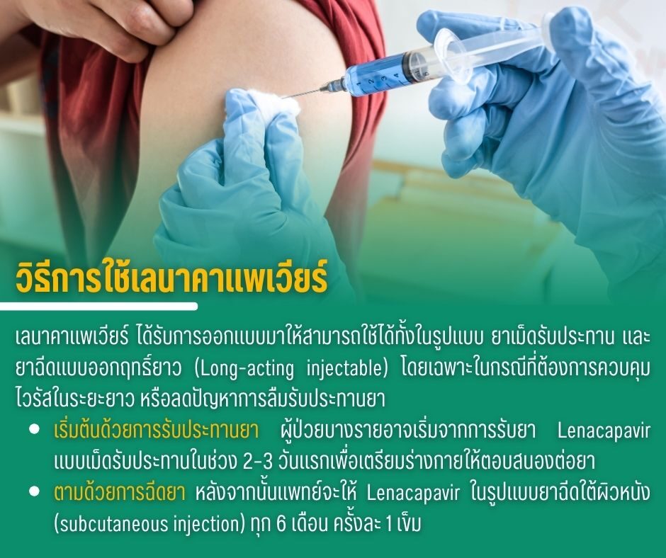 วิธีการใช้เลนาคาแพเวียร์