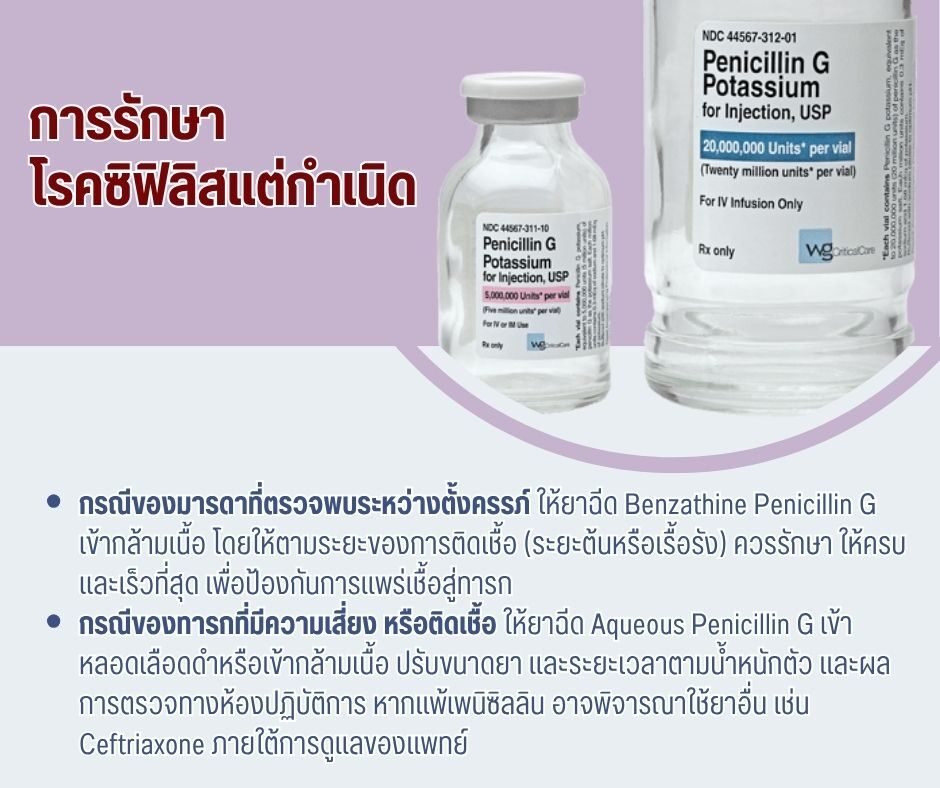 การรักษาโรคซิฟิลิสแต่กำเนิด