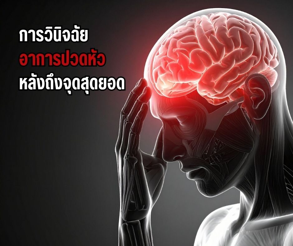 การวินิจฉัยอาการปวดหัวหลังถึงจุดสุดยอด