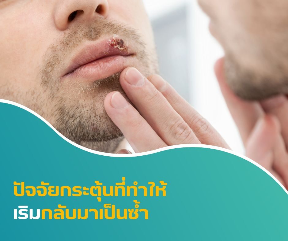 ปัจจัยกระตุ้นที่ทำให้เริมกลับมาเป็นซ้ำ