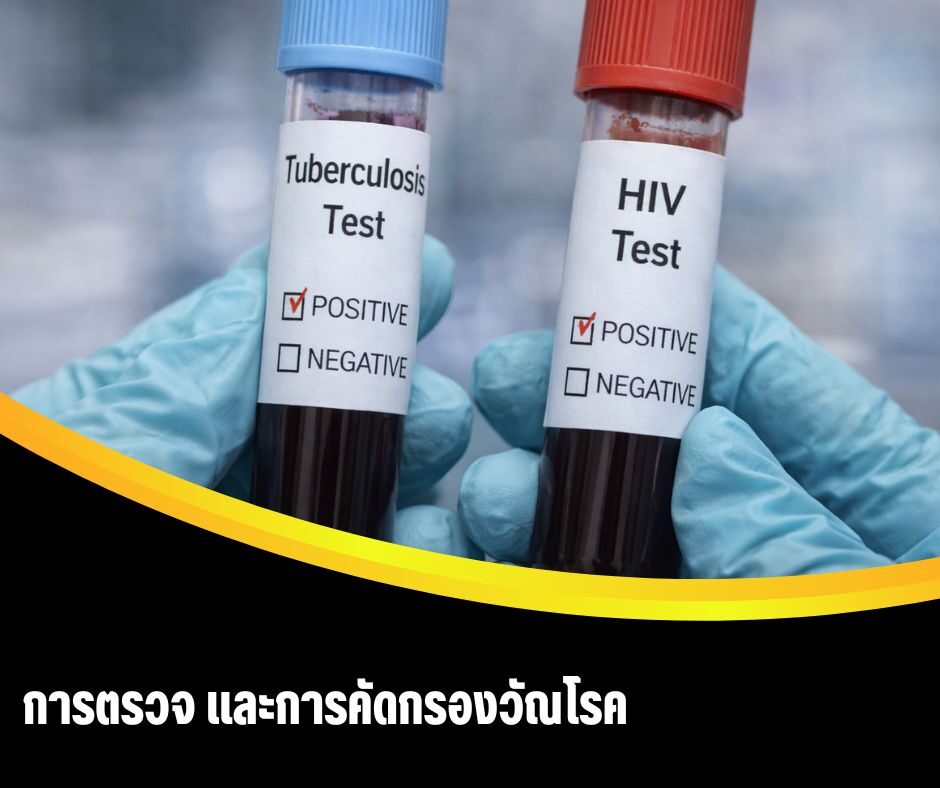 การตรวจ และการคัดกรองวัณโรค