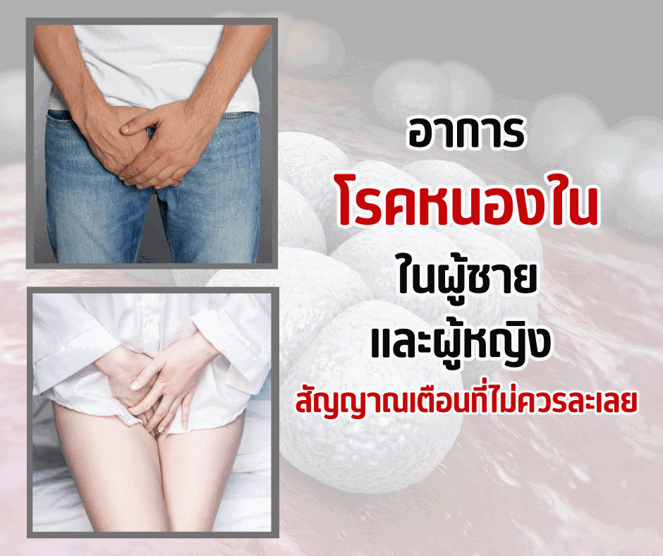 อาการโรคหนองในในผู้ชาย และผู้หญิง: สัญญาณเตือนที่ไม่ควรละเลย