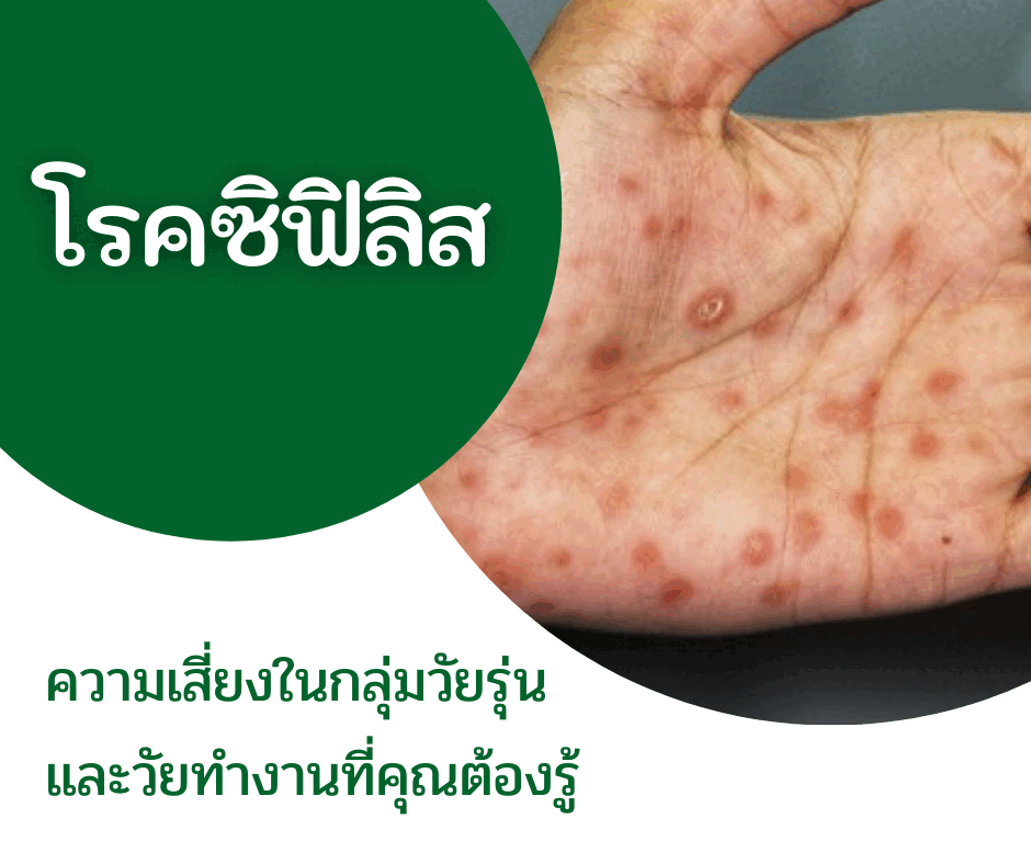 โรคซิฟิลิส : ความเสี่ยงในกลุ่มวัยรุ่น และวัยทำงานที่คุณต้องรู้