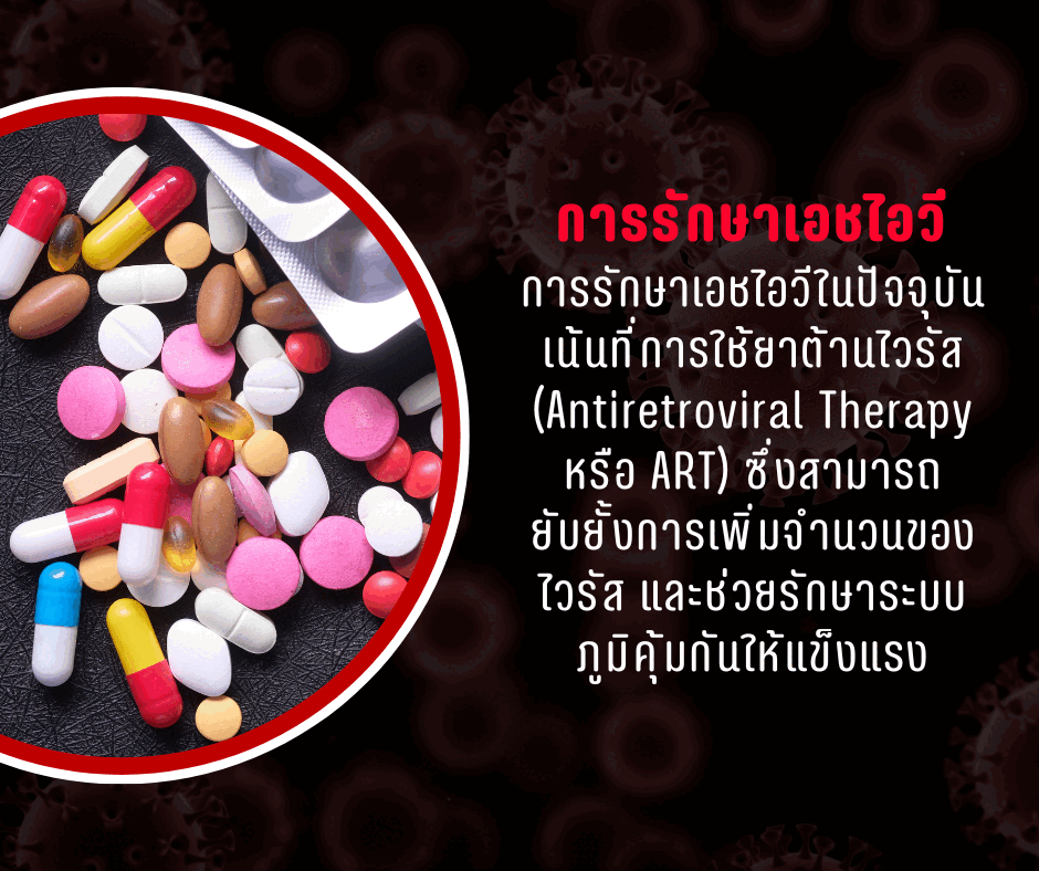 การรักษาเอชไอวี