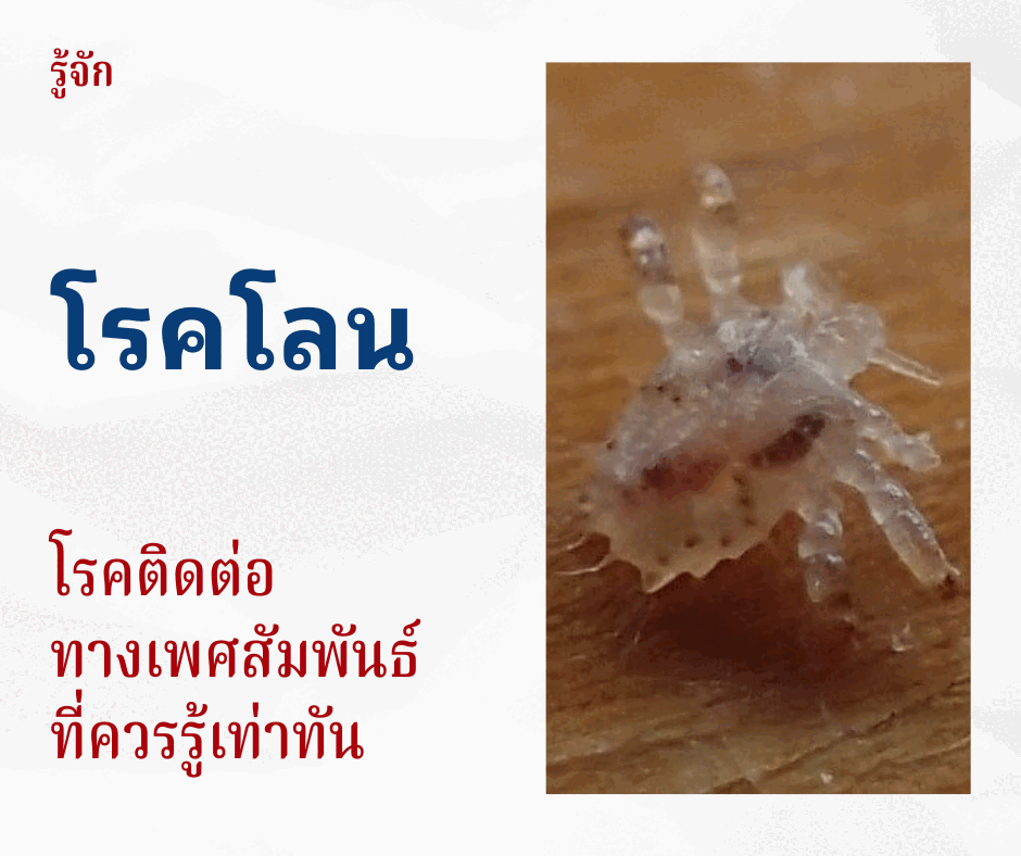 รู้จักโรคโลน โรคติดต่อทางเพศสัมพันธ์ที่ควรรู้เท่าทัน