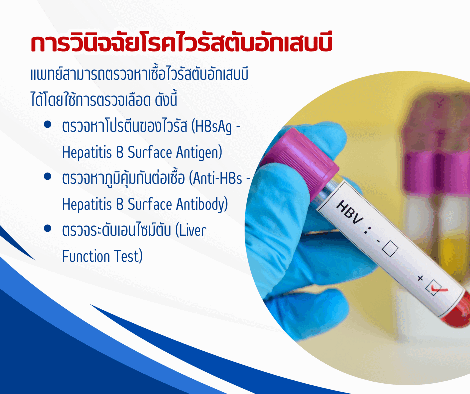 การวินิจฉัยโรคไวรัสตับอักเสบบี