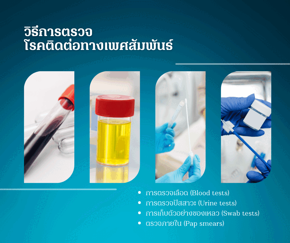 วิธีการตรวจโรคติดต่อทางเพศสัมพันธ์