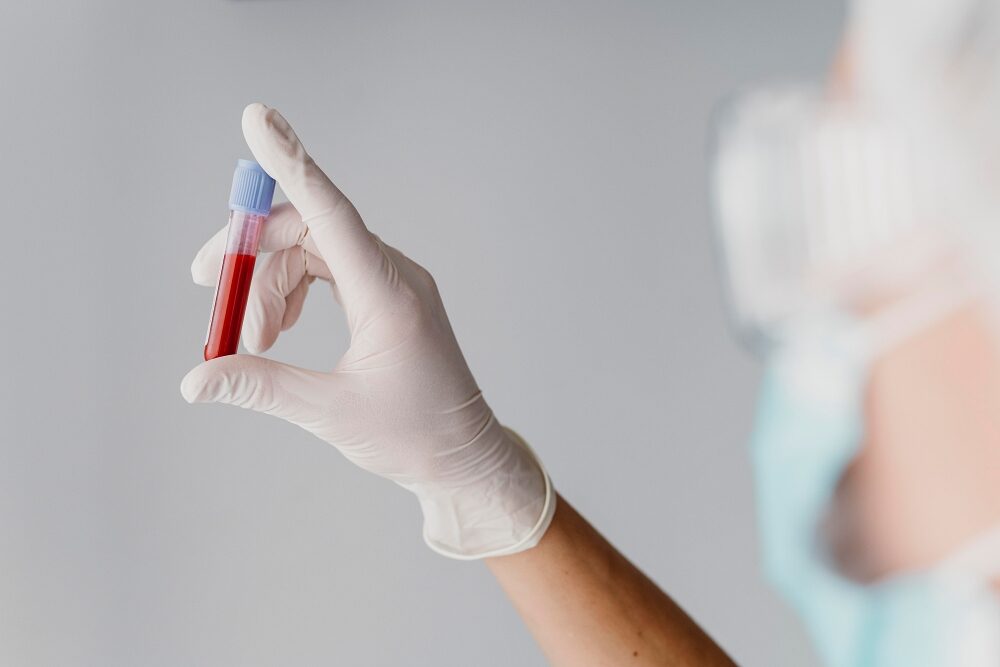 Love2Test เป็นโครงการที่ช่วยให้การตรวจเอชไอวีและโรคติดต่อทางเพศสัมพันธ์