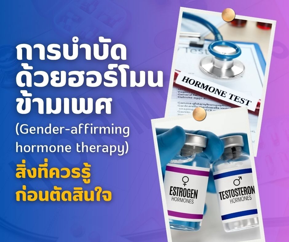 การบำบัดด้วยฮอร์โมนข้ามเพศ  (Gender-affirming hormone therapy) สิ่งที่ควรรู้ก่อนตัดสินใจ