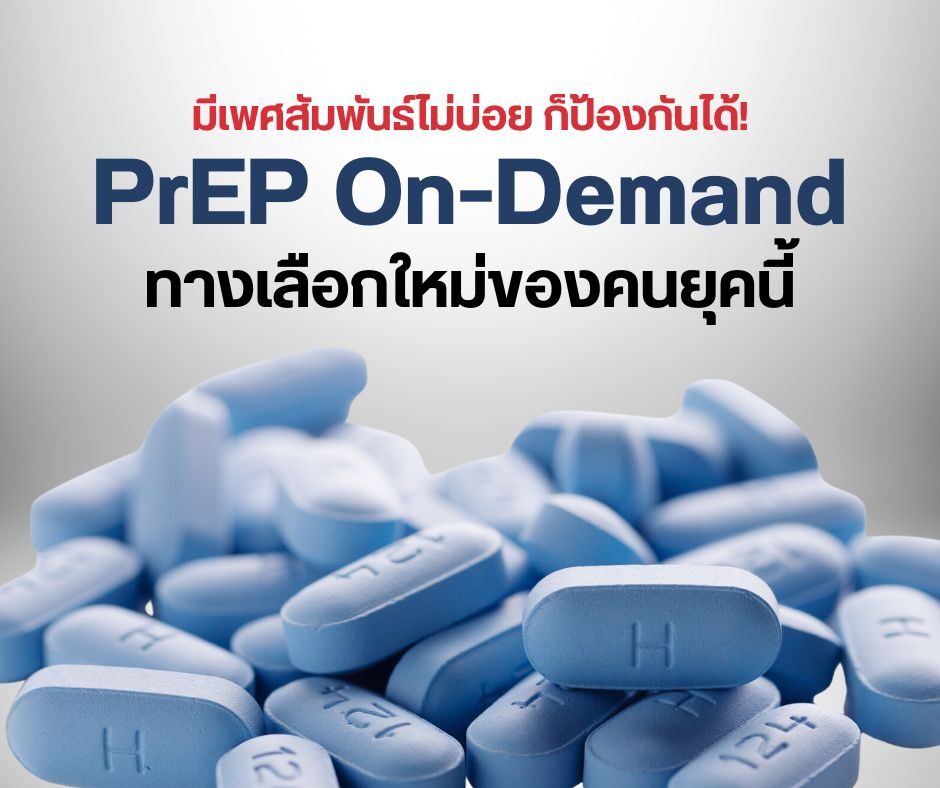 มีเพศสัมพันธ์ไม่บ่อย ก็ป้องกันได้! PrEP On-Demand ทางเลือกใหม่ของคนยุคนี้