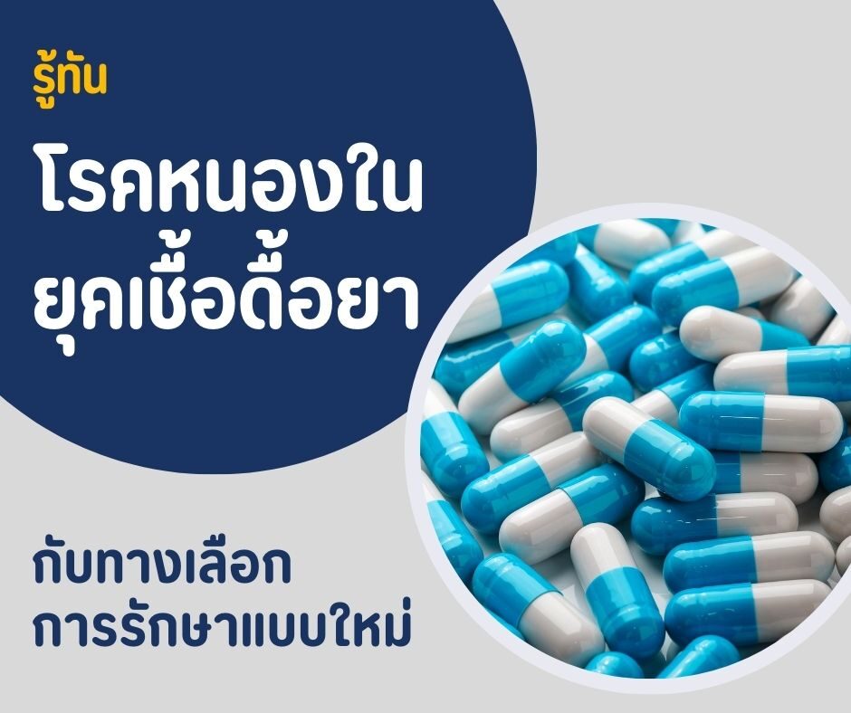 รู้ทันโรคหนองในยุคเชื้อดื้อยา กับทางเลือกการรักษาแบบใหม่