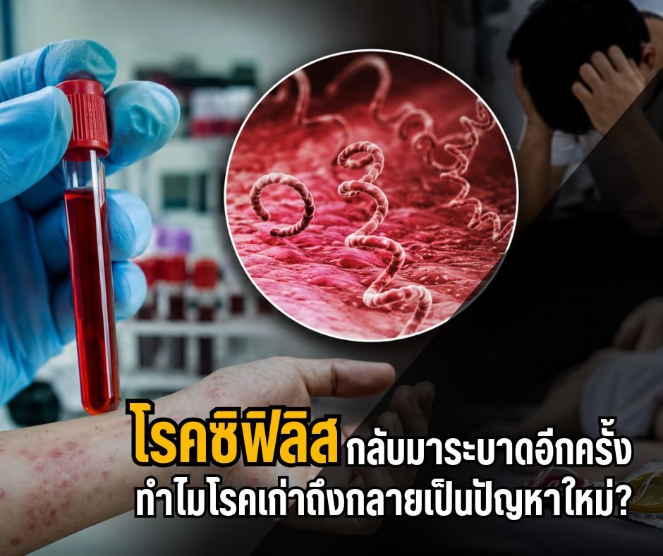 โรคซิฟิลิสกลับมาระบาดอีกครั้ง ทำไมโรคเก่าถึงกลายเป็นปัญหาใหม่?