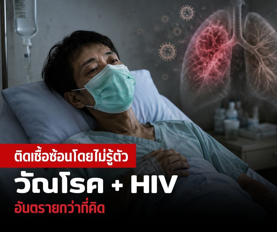 ติดเชื้อซ้อนโดยไม่รู้ตัว วัณโรค + HIV อันตรายกว่าที่คิด
