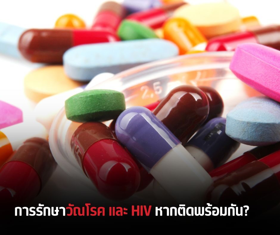 การรักษาวัณโรค และ HIV หากติดพร้อมกัน_วี