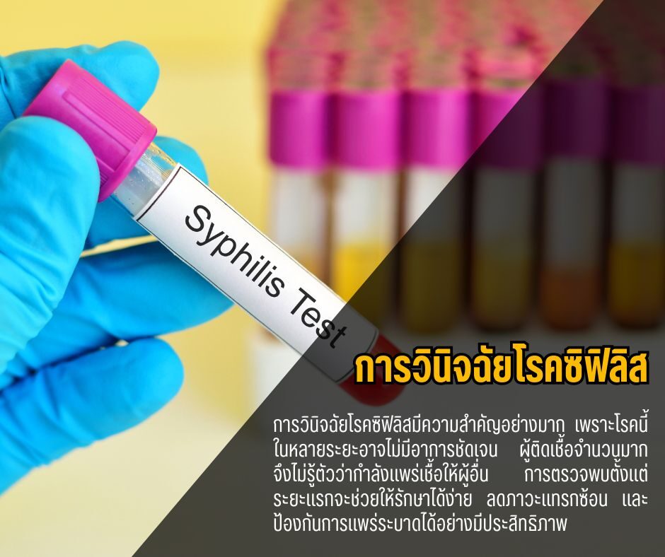 การวินิจฉัยโรคซิฟิลิส