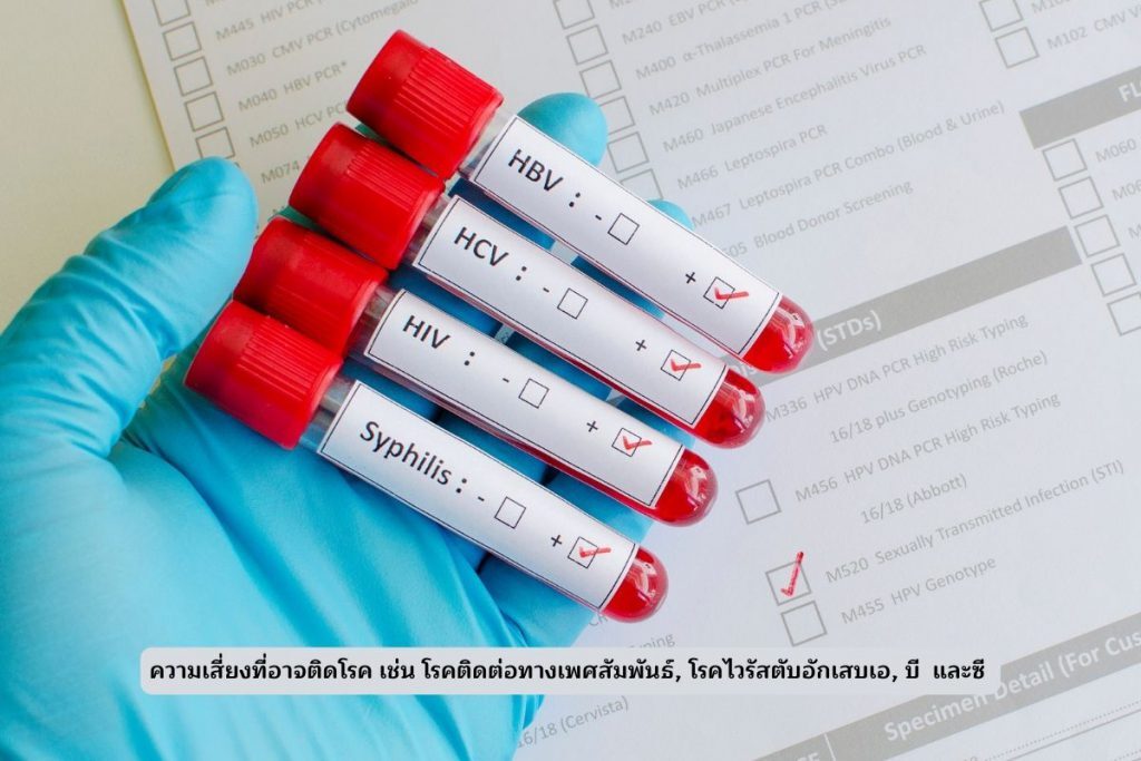 โรคจาก ออรัล เซ็กส์