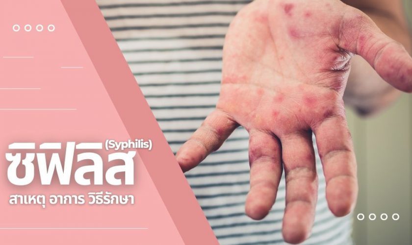 ซิฟิลิส | สาเหตุ อาการ วิธีรักษา