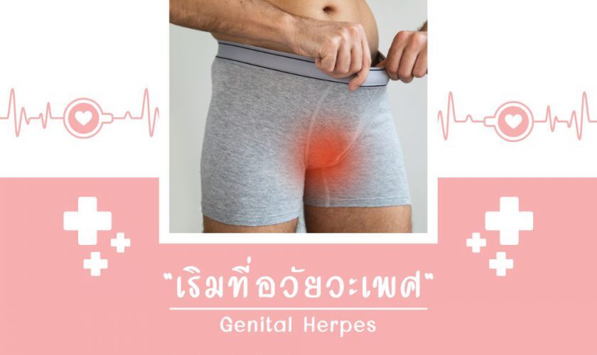 เริมที่อวัยวะเพศ | GENITAL HERPES