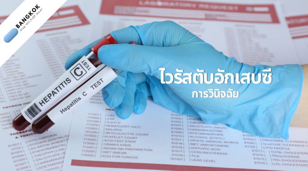 ไวรัสตับอักเสบซีการวินิจฉัย