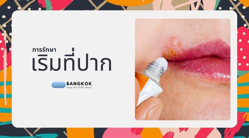 การรักษา เริมที่ปาก