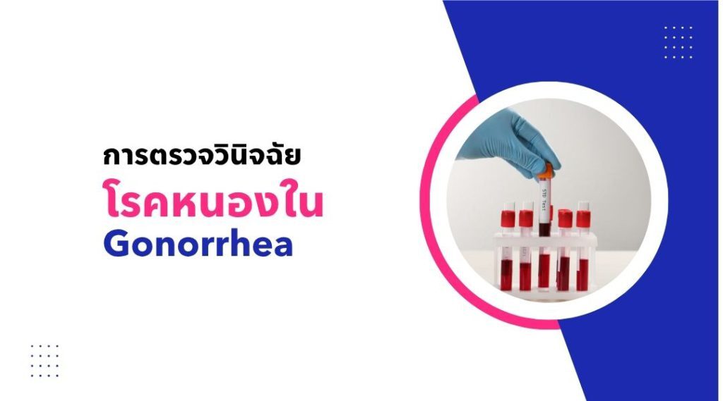 การตรวจวินิจฉัย โรคหนองใน Gonorrhea
