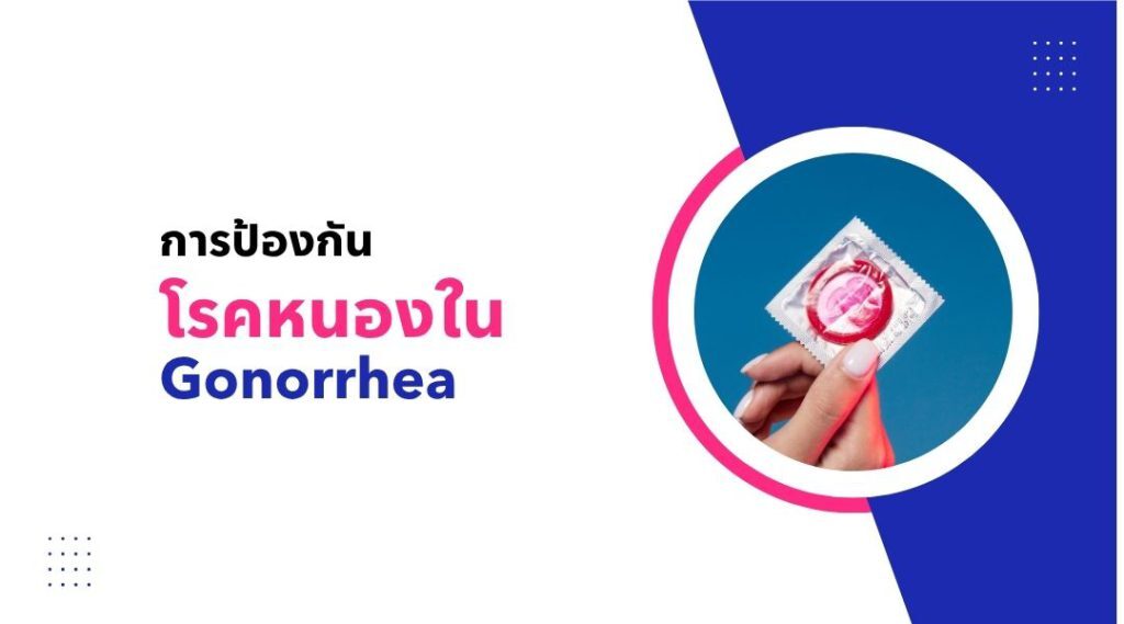 การป้องกันโรคหนองใน Gonorrhea