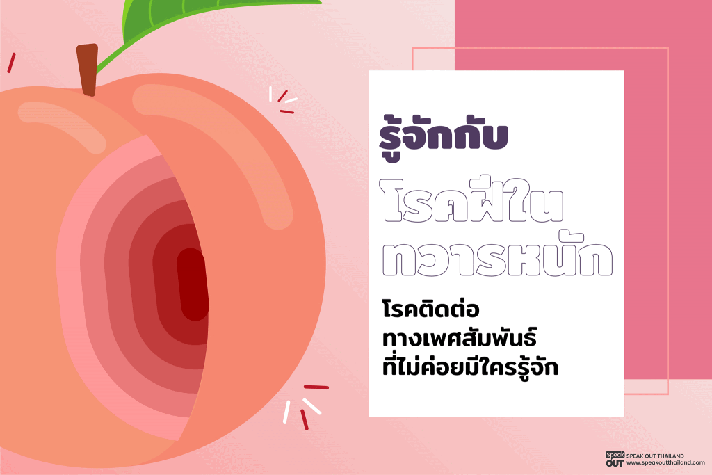 📣 รู้จักกับโรคฝีในทวารหนักโรคติดต่อทางเพศสัมพันธ์ที่ไม่ค่อยมีใครรู้จัก‼