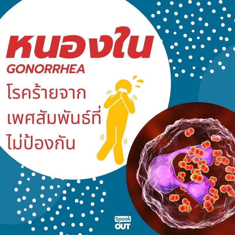หนองใน โรคร้ายจากเพศสัมพันธ์ที่ไม่ป้องกัน