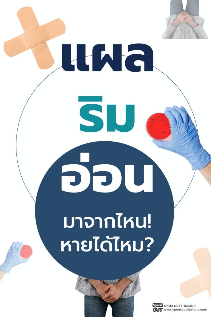 ℹ แผลริมอ่อน มาจากไหน! หายได้ไหม?