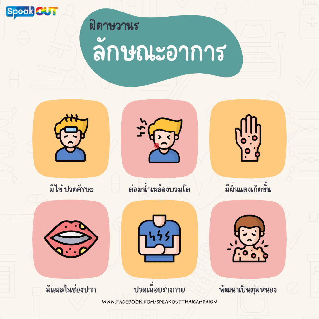 อาการทั่วไปของ ฝีดาษวานร